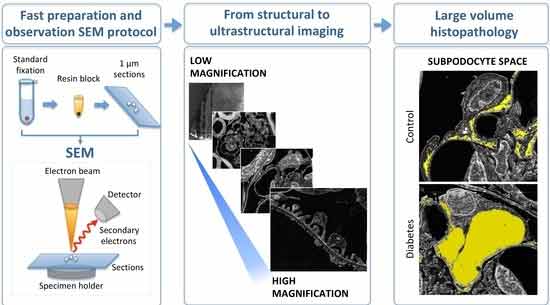 sem analysis process